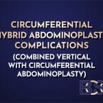 Circumferential Hybrid Abdominoplasty Complications (Combined Vertical with Circumferential Abdominoplasty)