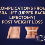 Complications After Bra lift (Upper Back lipectomy): What Patients Need to Know