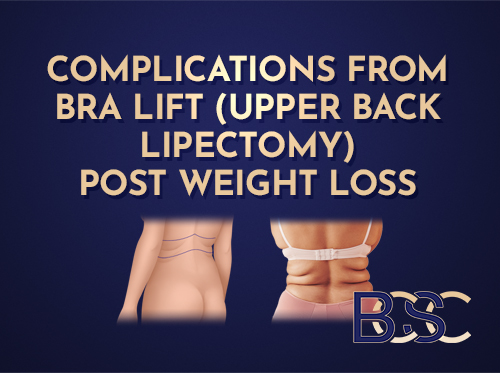 Complications After Bra lift (Upper Back lipectomy): What Patients Need to Know