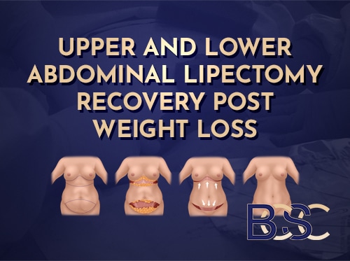 Upper and Lower Abdominal Lipectomy Recovery Post Weight Loss