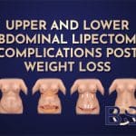 Upper and Lower Abdominal Lipectomy Complications Post Weight Loss