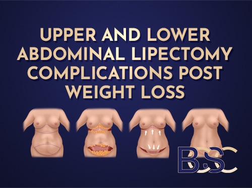 Upper and Lower Abdominal Lipectomy Complications Post Weight Loss