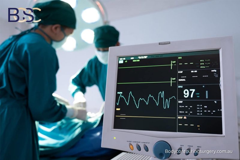 Circumferential hybrid abdominoplasty combining a vertical lipectomy with belt lipectomy Final Thoughts Circumferential hybrid abdominoplasty combining a vertical lipectomy with belt lipectomy