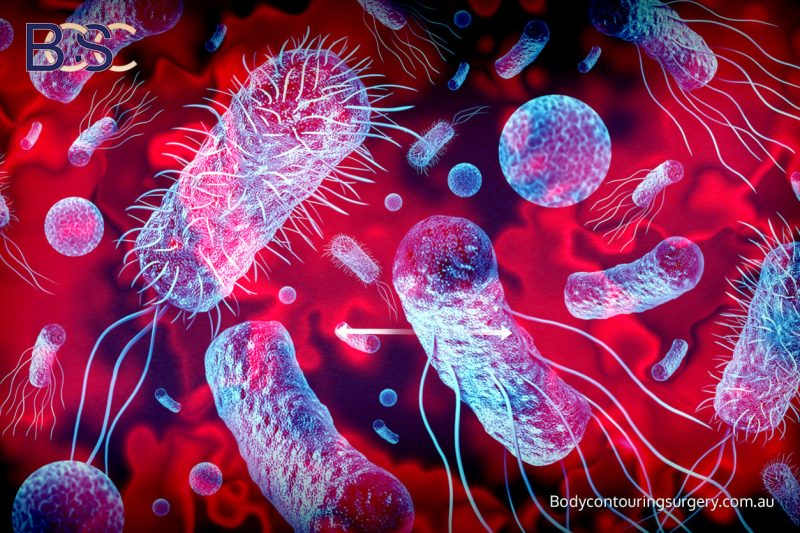 Risks and Potential Complications - BCSC