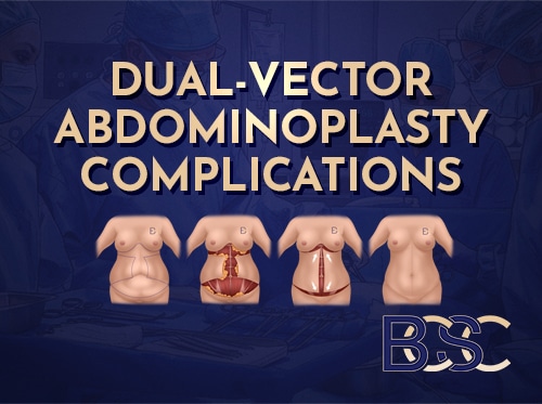 Dual-vector Abdominoplasty Complications