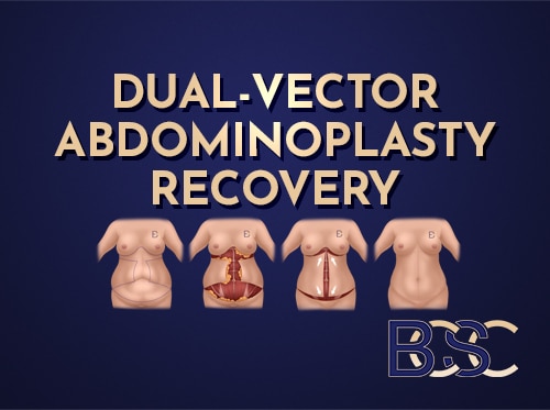 Dual-vector Abdominoplasty Recovery