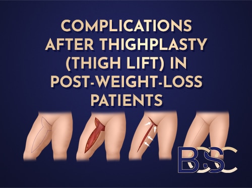 Complications After Thighplasty in Post‑Weight‑Loss Patients