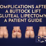 Complications After a Buttock Lift (Gluteal Lipectomy), a Patient Guide
