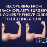 Recovering From Brachioplasty Surgery: A Comprehensive Guide to Healing & Care