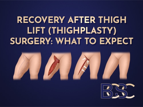 Recovery After Thigh Lift (Thighplasty) Surgery: What to Expect
