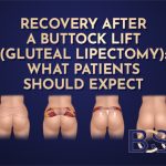 Recovery After a Buttock Lift (Gluteal Lipectomy): What Patients Should Expect