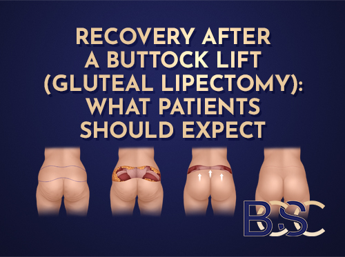 Recovery After a Buttock Lift (Gluteal Lipectomy): What Patients Should Expect