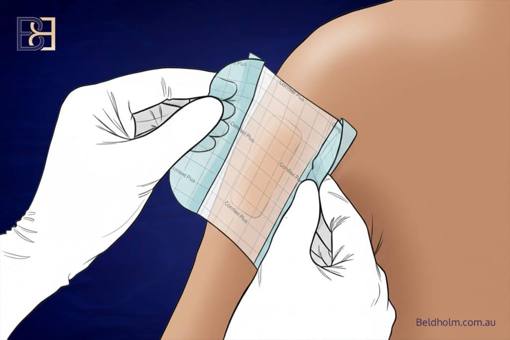Comfeel Dressings