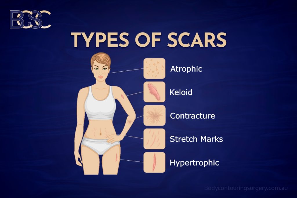 Types of scaring