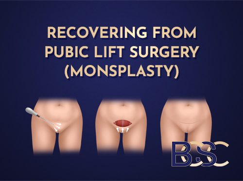 Recovering from Pubic Lift Surgery (Monsplasty)
