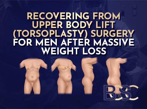 Recovering From Upper Torsoplasty (Body Lift) Surgery for Men After Massive Weight Loss